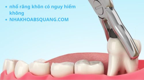nhổ răng khôn có nguy hiểm không