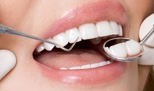 Chi phí Bọc Răng Sứ: Những Yếu Tố Ảnh Hưởng