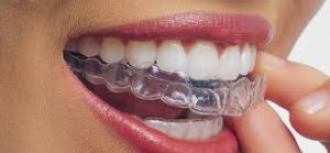 Chỉnh Hình Hàm Mặt Thẩm Mỹ: Cải Thiện Khuôn Mặt và Sức Khỏe