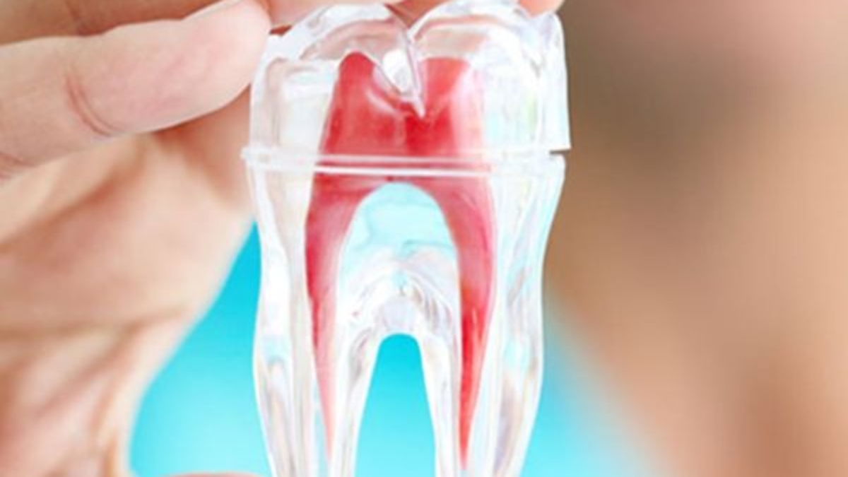 Làm Răng Thẩm Mỹ: Giải Pháp Hoàn Hảo Cho Nụ Cười Tỏa Sáng