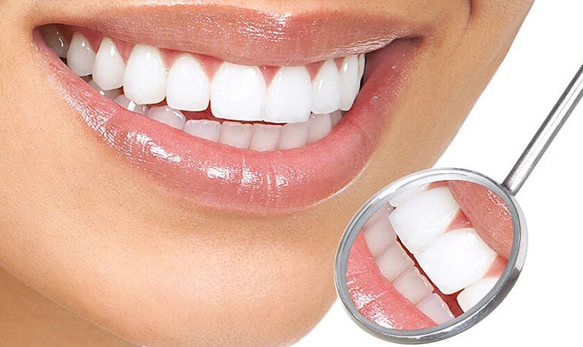 Phục Hình Răng Thẩm Mỹ: Bí Quyết Cho Nụ Cười Hoàn Hảo